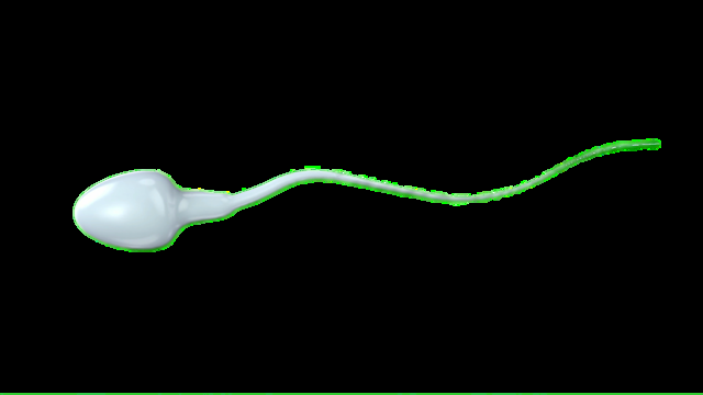 Imagem de espermatozoide